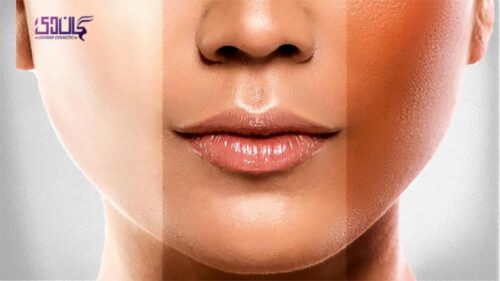قبل و بعد استفاده از صابون روشن کننده صورت و بدن گلوتانکس